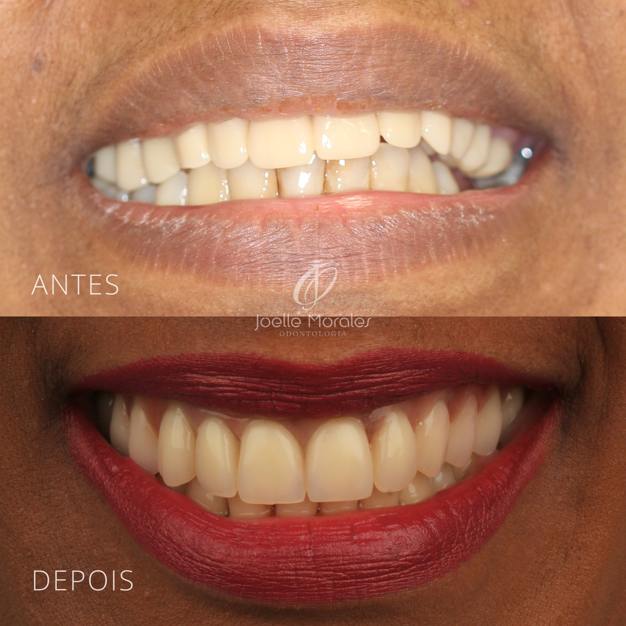 Antes e depois 9
