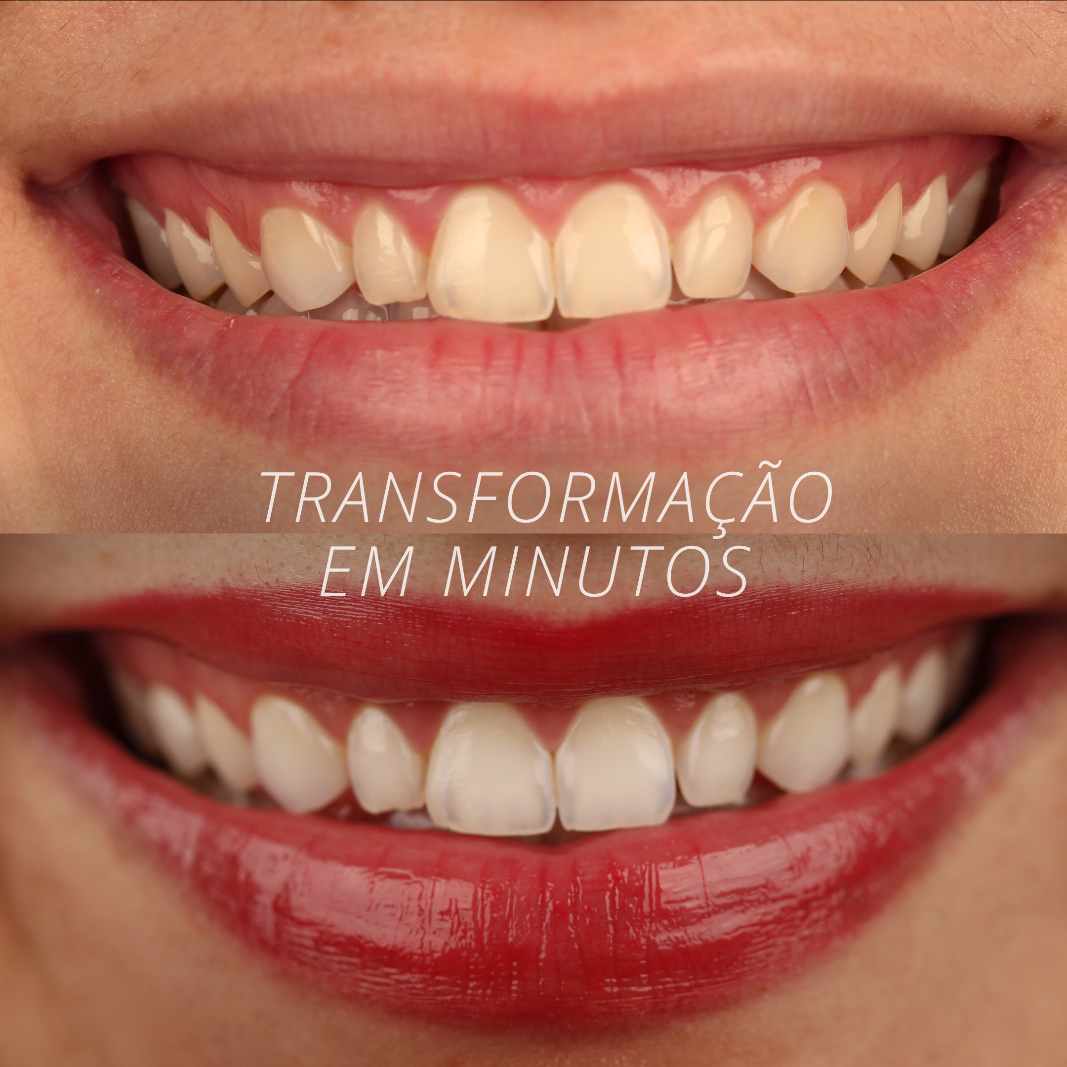 Antes e depois 7