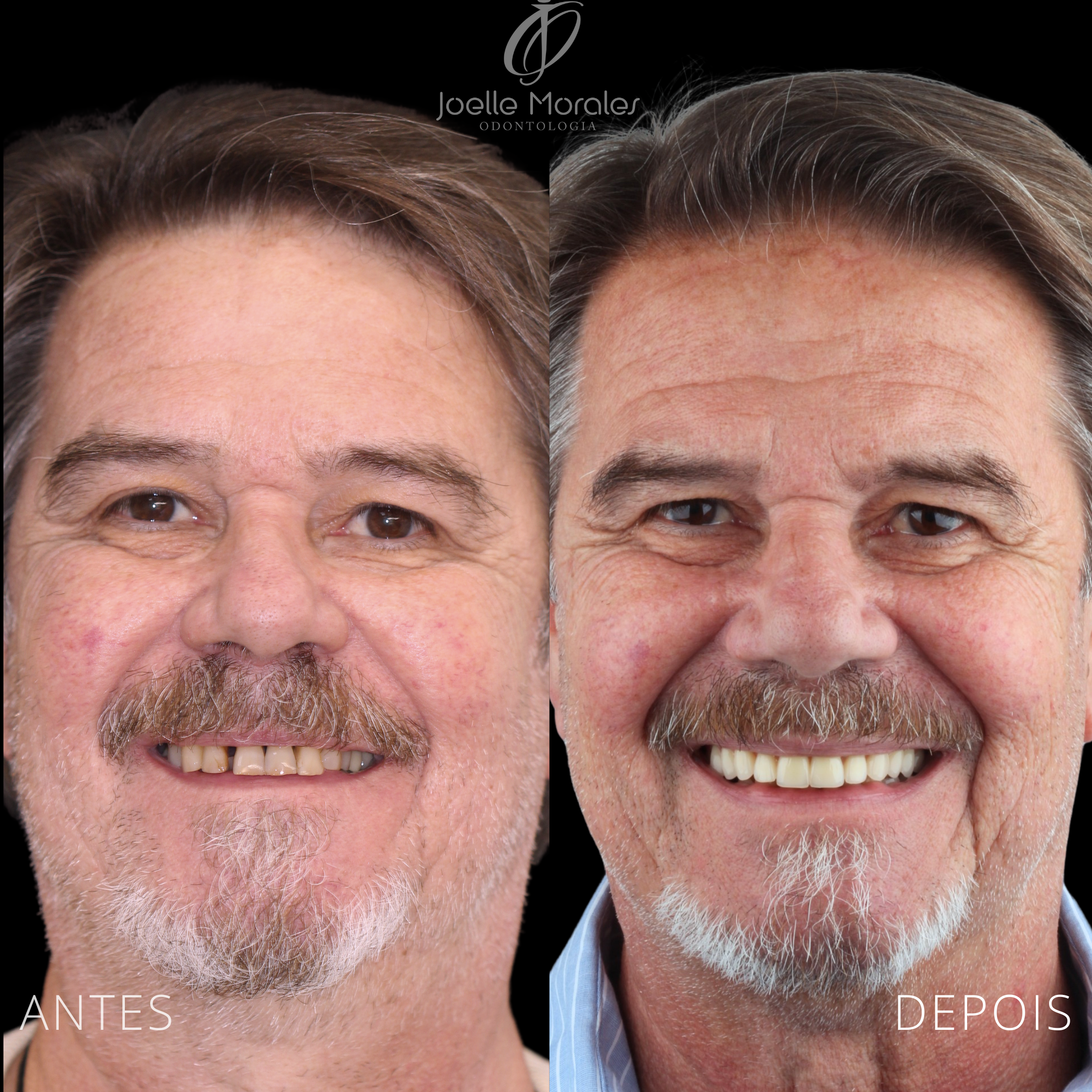 Antes e depois 3
