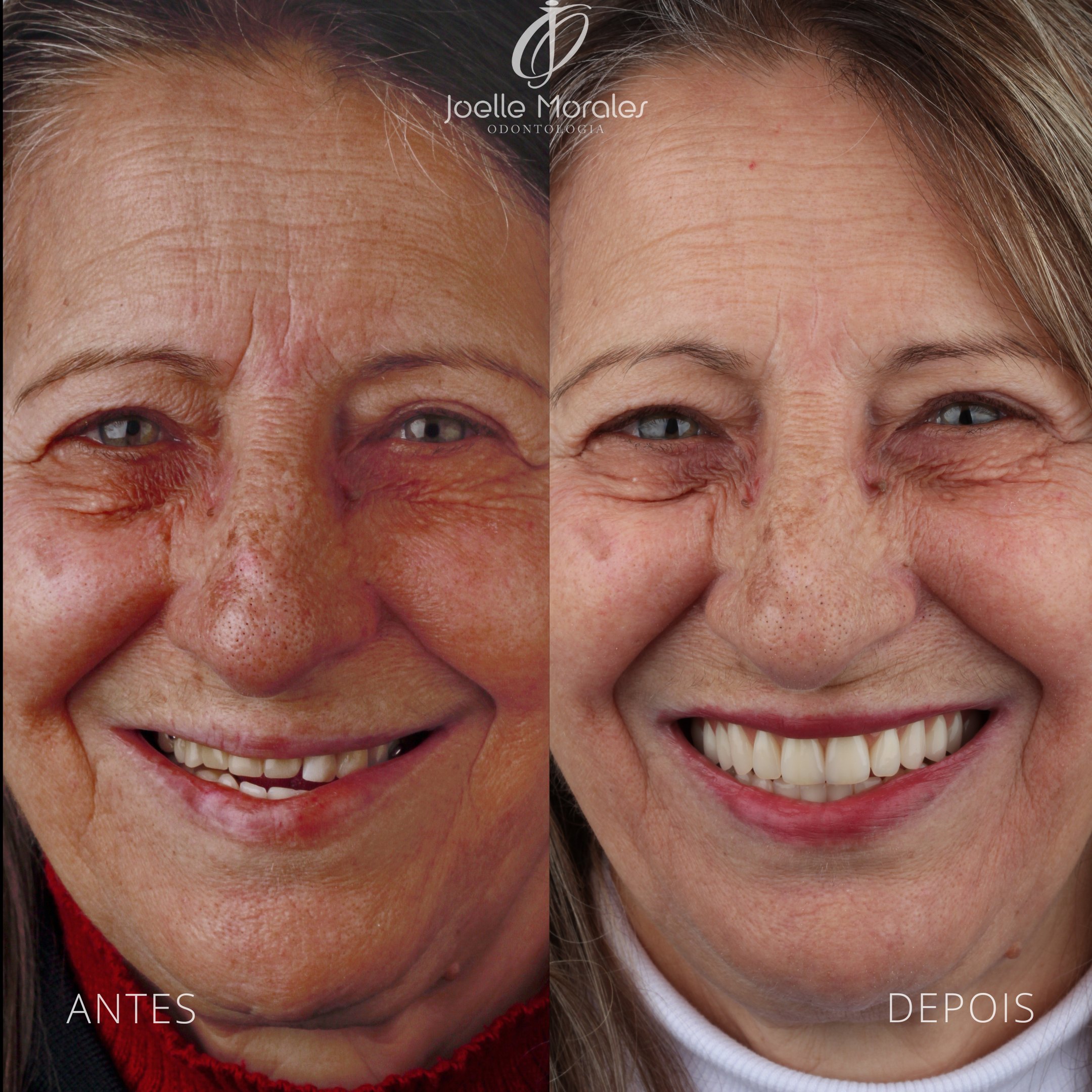 Antes e depois 6
