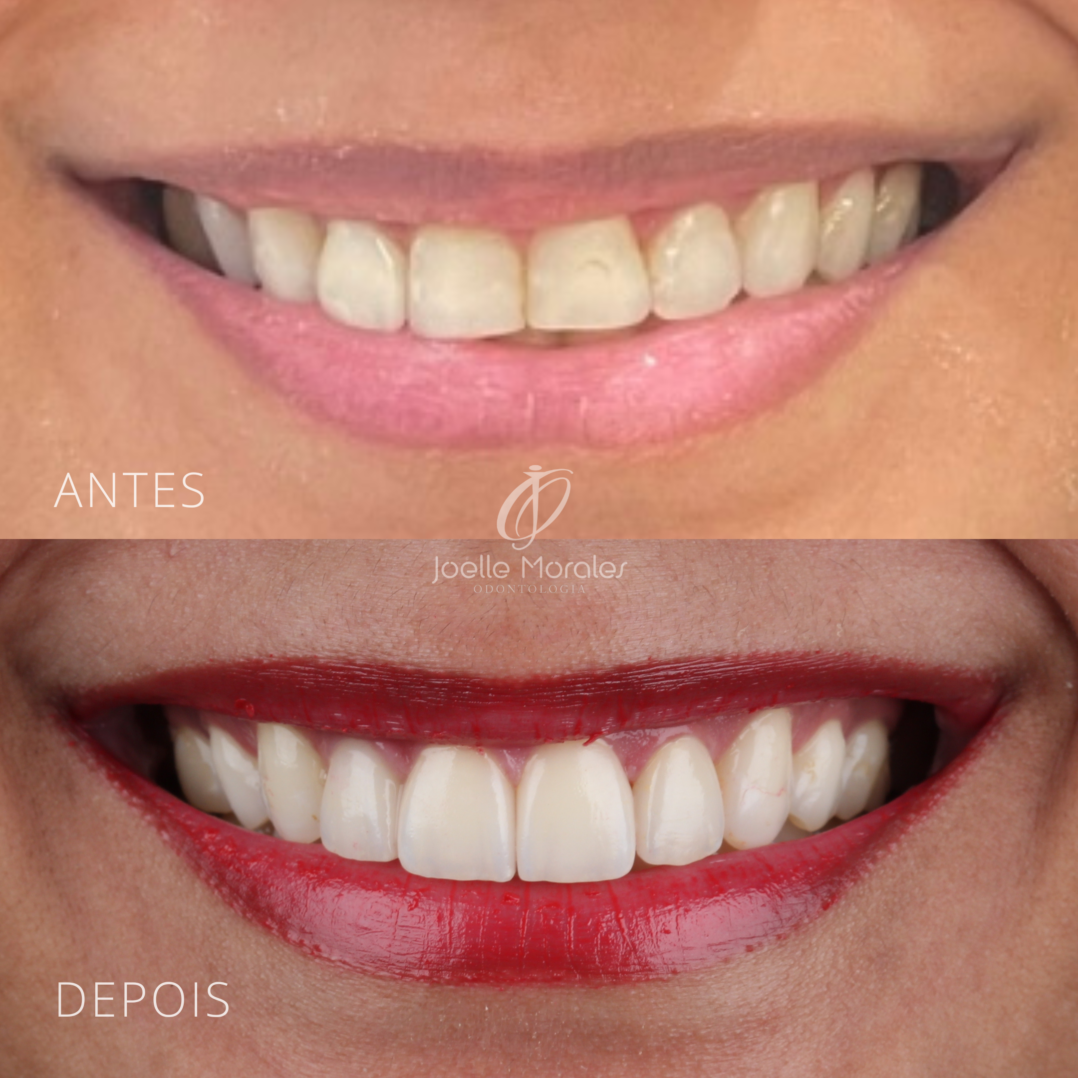 Antes e depois 8